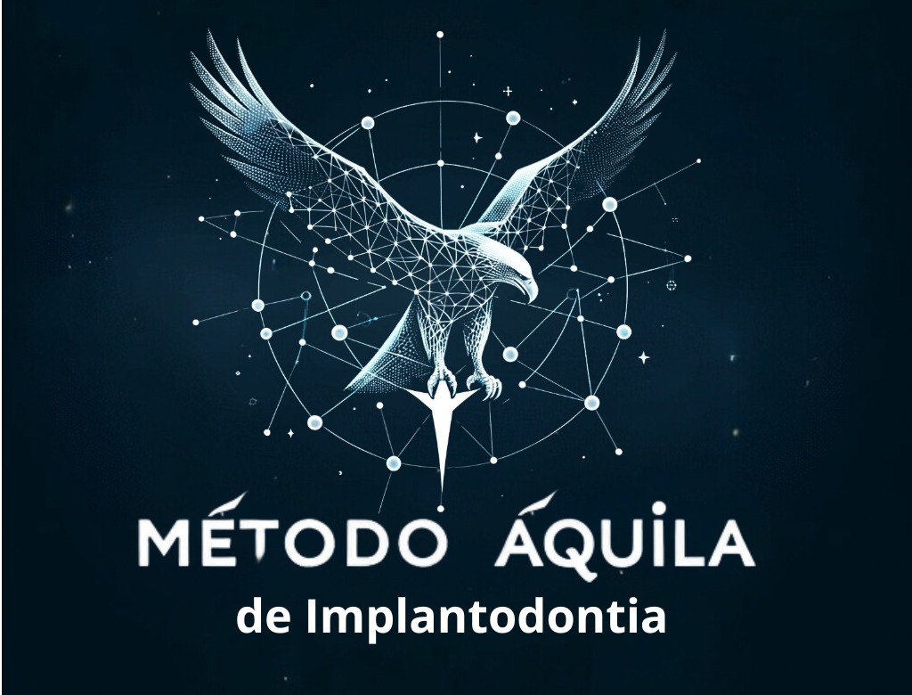 Método Áquila de Implantodontia